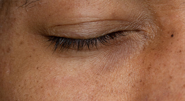 AdobeStock 329164983 Eye Floaters